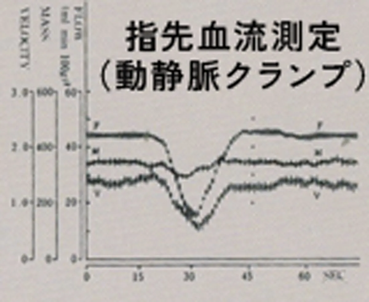 指先血流測定(動静脈クランプ)