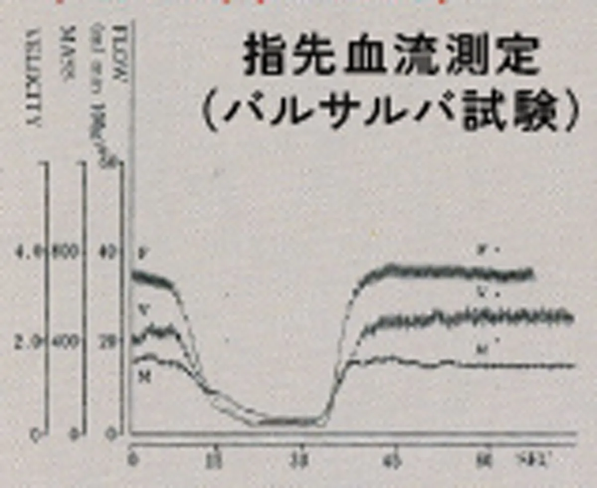 指先血流測定(バルサルバ試験)