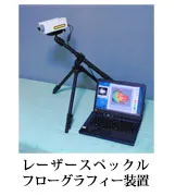 レーザースペックル フローグラフィー装置